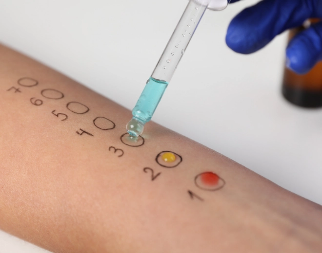 Visita allergologica e test per allergie nei Centri Medici Ergéa