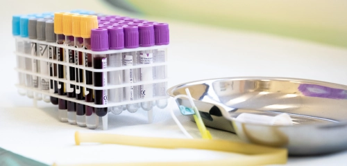 Centro prelievi e analisi di laboratorio nei Centri Medici Ergéa