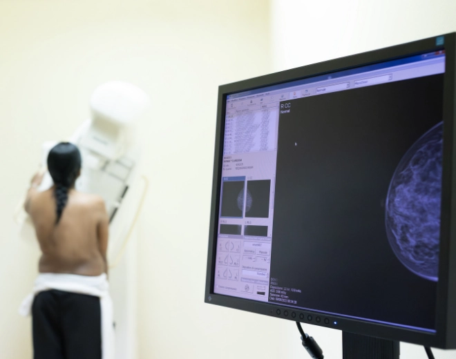 Mammografia 3D con tomosintesi nei Centri Medici Ergéa