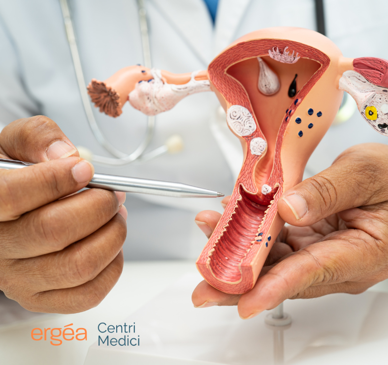 Tumore all'utero i sintomi e i fattori di rischio