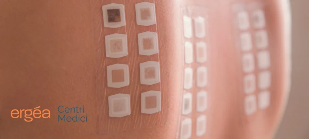 Test diagnostici per l'allergia alimentare