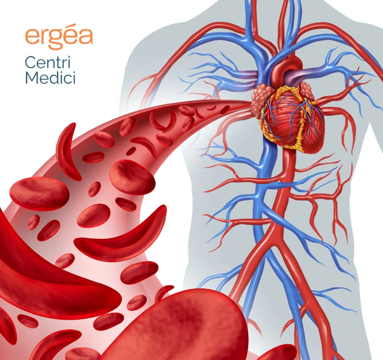 problemi di circolazione sintomi